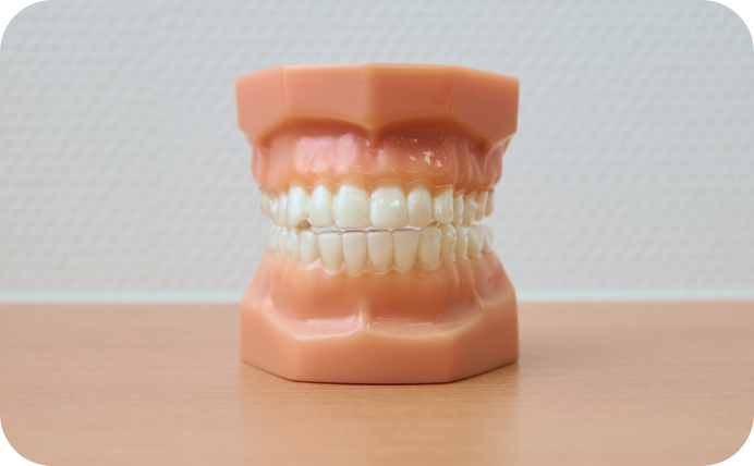 マウスピース型矯正装置のイメージ画像