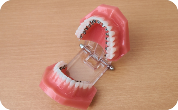 舌側矯正のイメージ画像