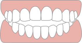噛み合わせが悪いのイメージ画像
